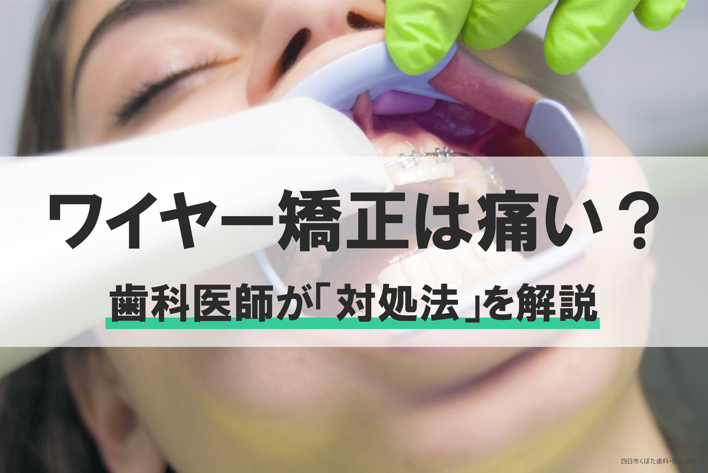 ワイヤー矯正は痛い 痛みの種類や対処法について歯科医師が解説 三重県四日市市で歯医者なら 四日市くぼた歯科 矯正歯科